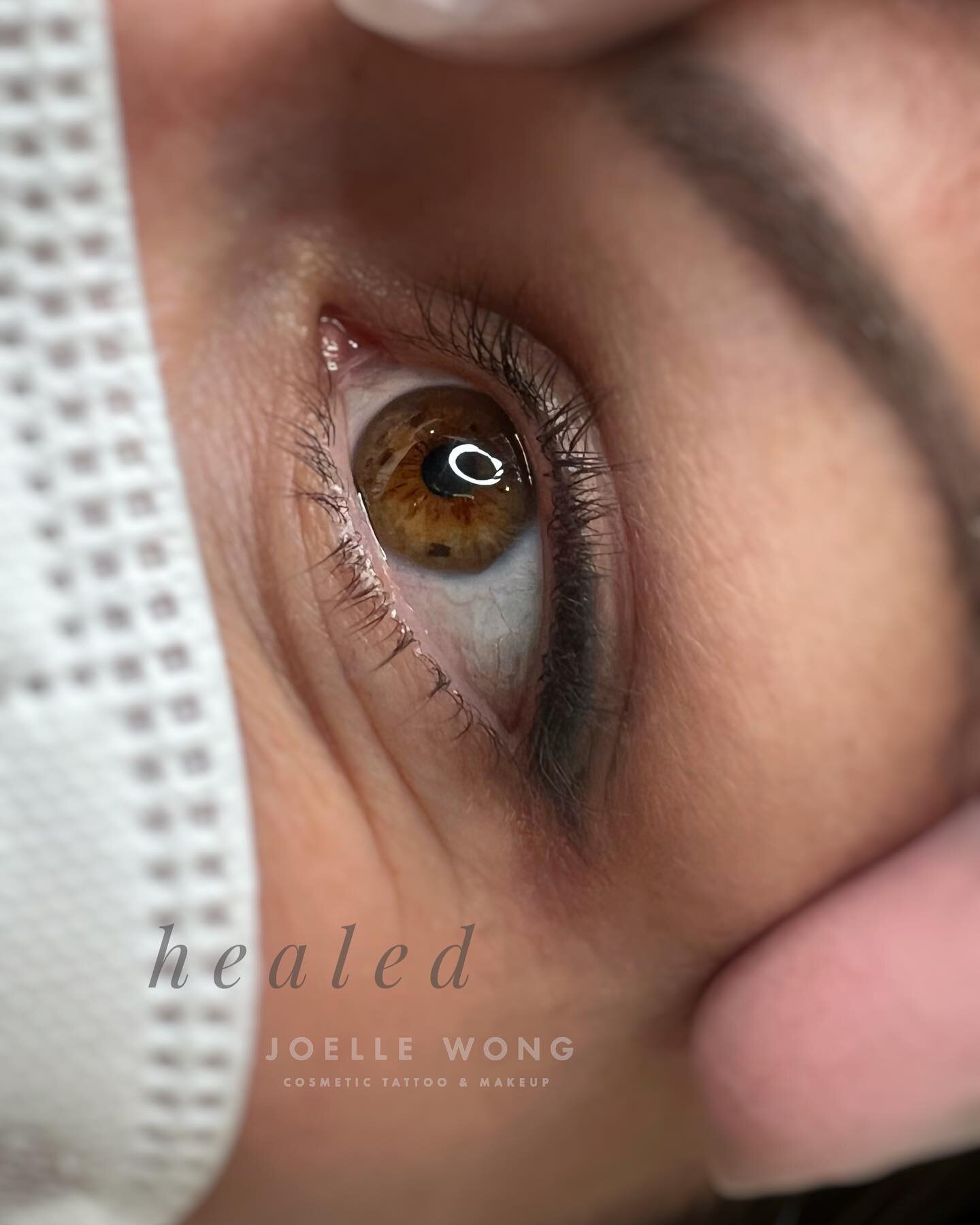 H E A L E D
Smokey Eyeliner healed after 8 months, 2 sessions.

Smokey Eyeliner usually looks like you've taken a pencil liner and smudged it.  It's a very natural everyday look that you can play up with a liquid liner on your fancy days!

All proced