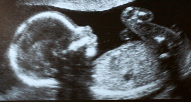 Fourth Sunday of Advent 