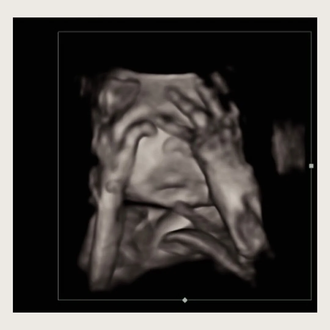 How we all feel about Monday🤍 
.
.
#pregnancy #mondayblues #baby #bump #boutique #westchestercounty #fairfieldcounty #maternity #3D #4D