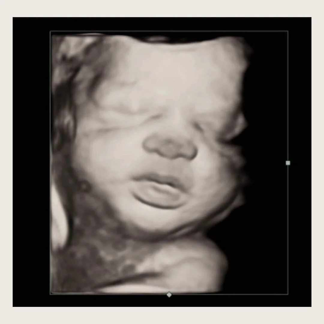cute as a button🤍 
.
.
#baby #pregnancy #3Dultrasound #westchestercounty #fairfieldcounty #mountkiscomoms #4Dultrasound #genderreveal