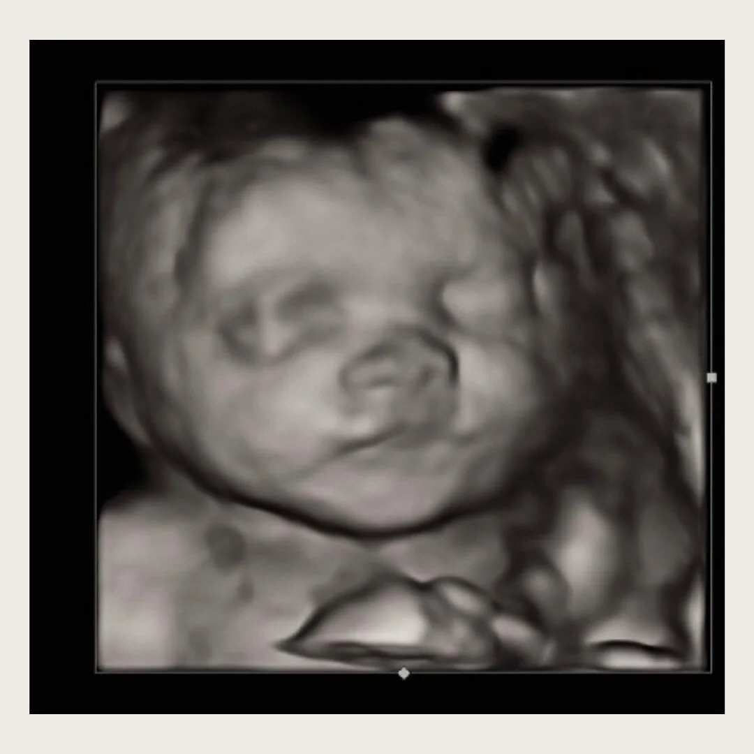 Sweet cheeks🤍 
.
.
#3D #baby #maternity #mountkisco #4D #ultrasound #babyboutique #westchester