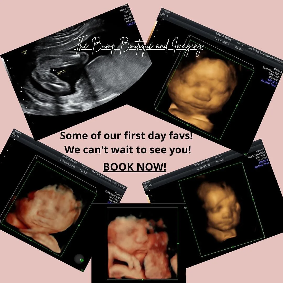 Hello loves! Amazing reopening day at the Bump Boutique and Imaging! We are conveniently located off of main street in Fishkill, minutes from I 84. Spots are filling up, so go online to book today! We can't wait to see you!
www.thebumpboutiqueandimag