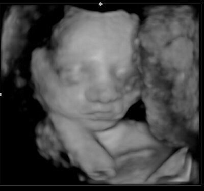 Southern Dutchess County 3D / 4D Ultrasound Imaging & Baby Boutique