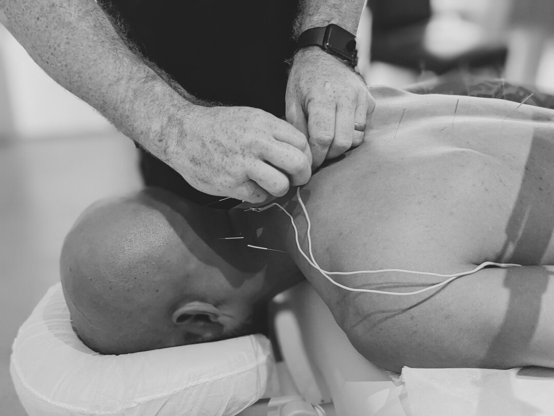 A modern enhancement to traditional acupuncture healing. ​​​​​​​​​​​​​​​​
​​​​​​​​​​​​​​​​
E-stim, also known as Electrical Stimulation Therapy or Electroacupuncture, involves the application of gentle electric currents to acupuncture points. ​​​​​​​