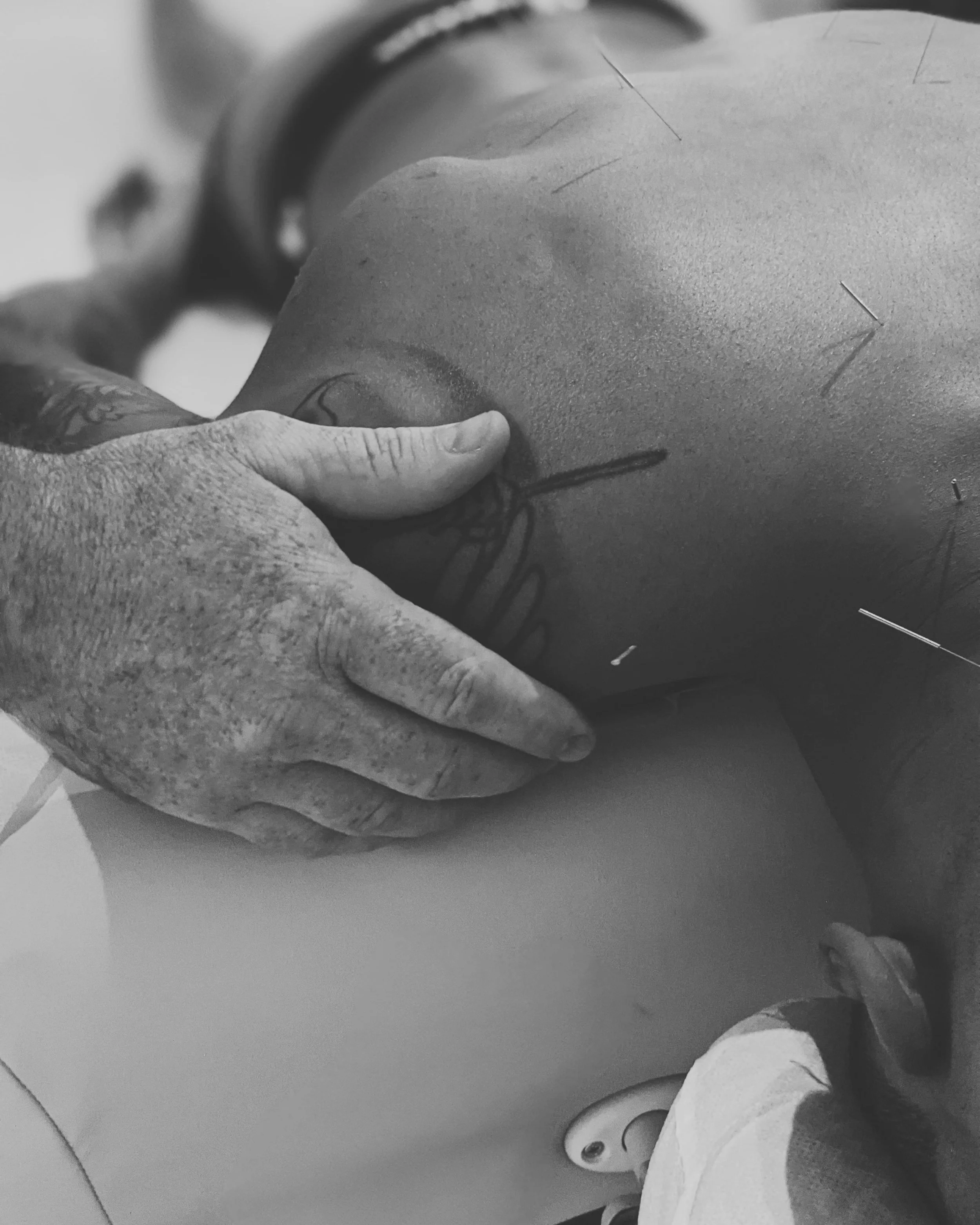 Find Your Chi Acupuncture