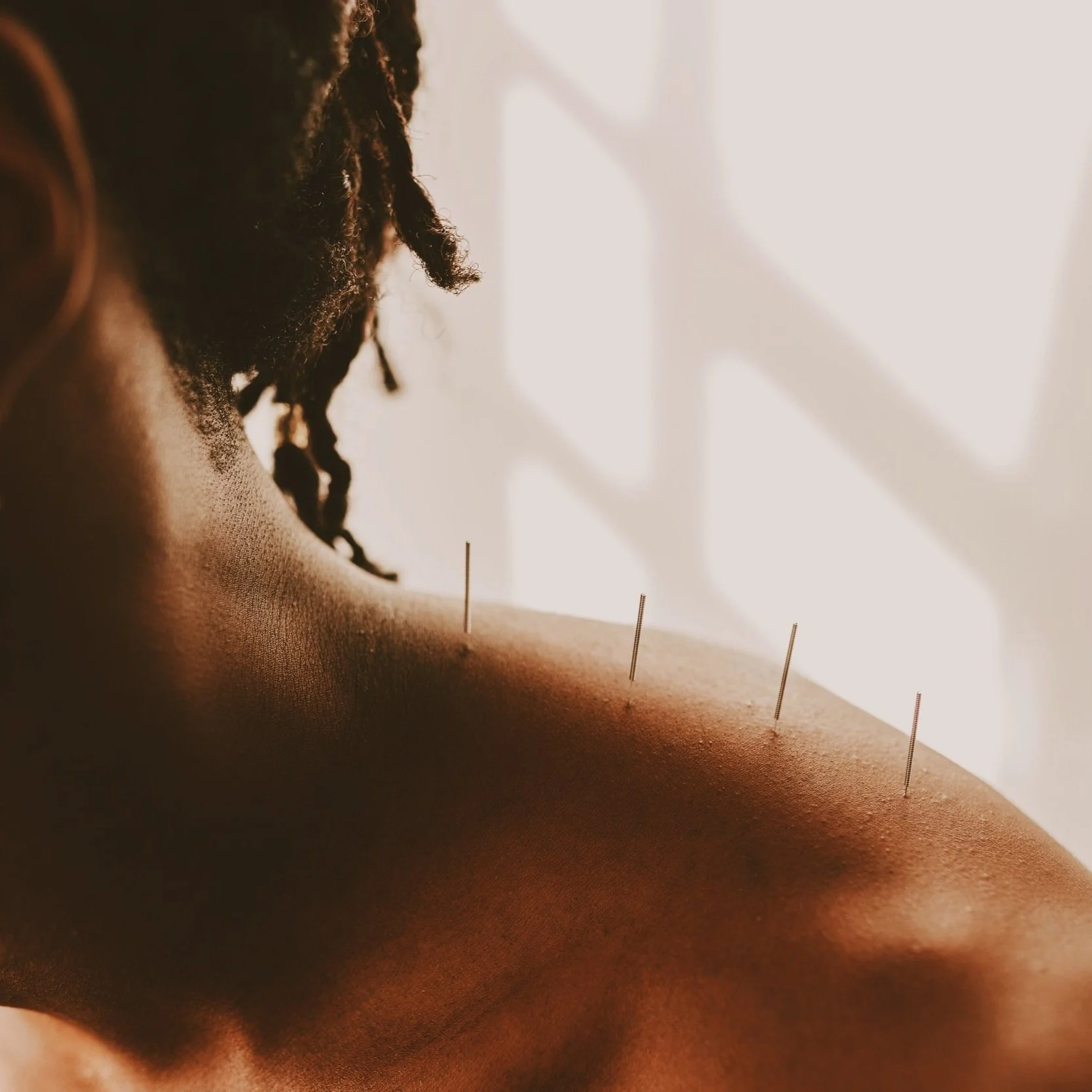 Find Your Chi Acupuncture