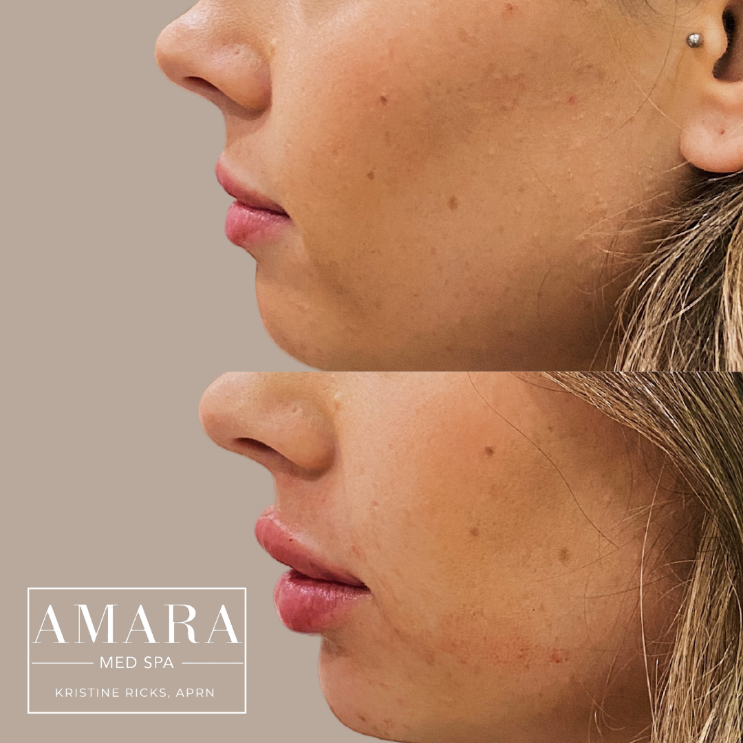 Gallery — The Amara Med Spa