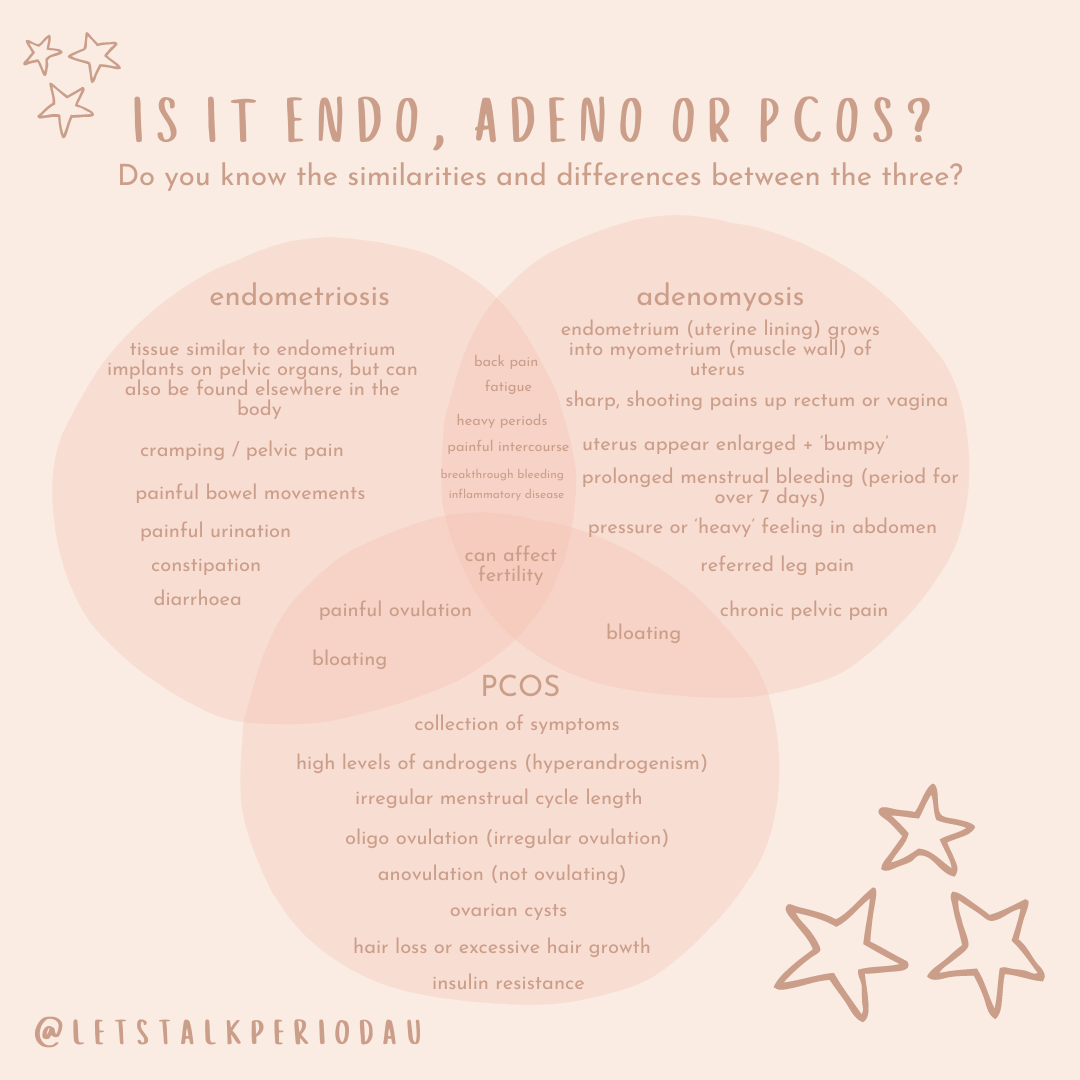 Differences between period pain, endometriosis & PCOS