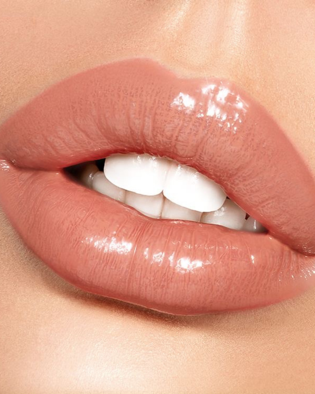 How does Versa+ compare to other fillers?
