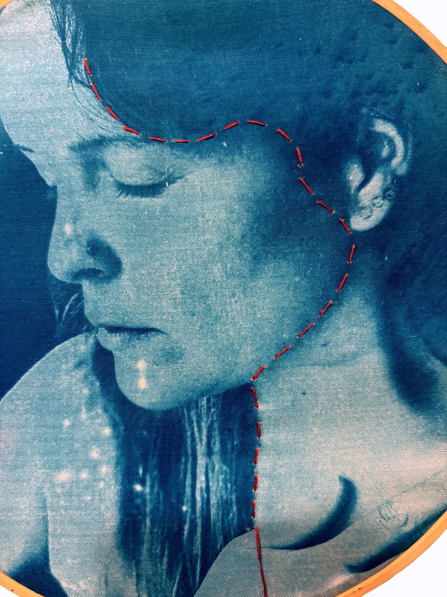 Une photographie monochrome bleue d'une jeune fille avec une ligne de couture rouge dessinée sur son visage et son cou.