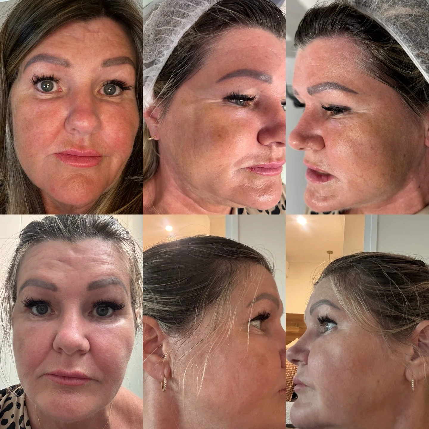 We&rsquo;re not tweaking skin&hellip; we&rsquo;re resetting the settings ✨

This is what real correction looks like.
Not filters. Not fluff. Not another &ldquo;glow&rdquo; that fades in a week.