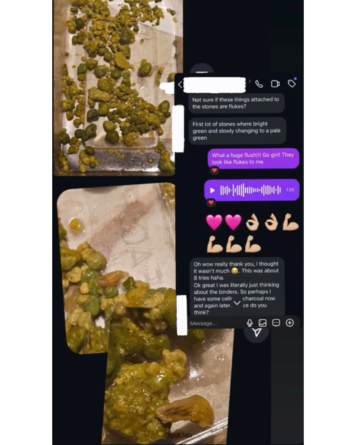 Liver flush images of liver stones and gallstones and liver sludge