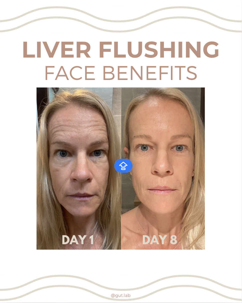LIVER FLUSH BEAUTY BENEFITS, BEFORE AND AFTER PHOTOS