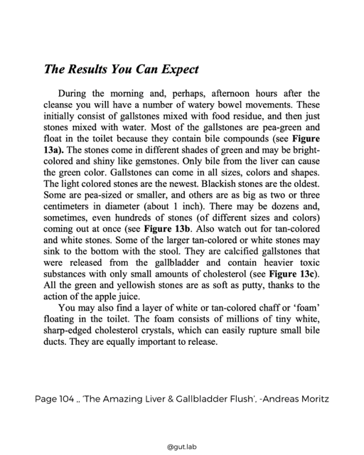 A page from a book titled "The Results You Can Expect" explaining the color and composition of gallstones and other stones in the human body, mentioning specific figures and their descriptions.