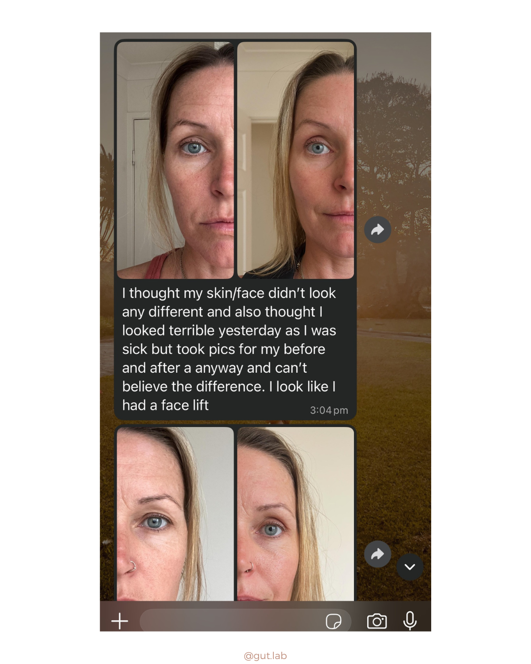 liver flush before and after images, beauty benefits. Natural botox