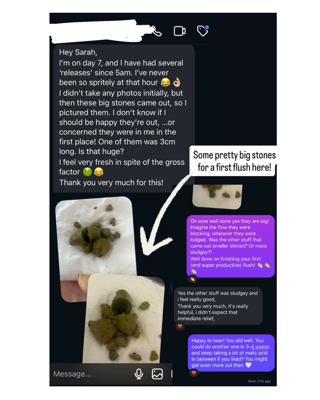 Messaging app screenshot showing a conversation about a person's experience with stones, with photos of greenish stones on paper towels, and chat comments praising the results of flushing out stones.
