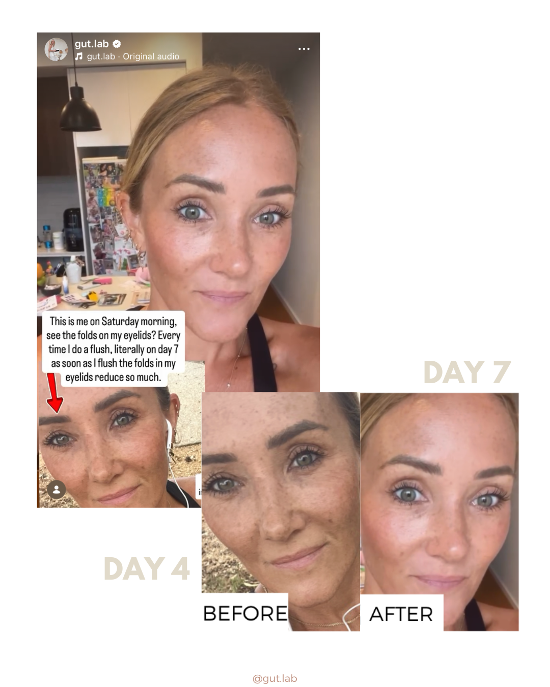 liver flush before and after images, beauty benefits