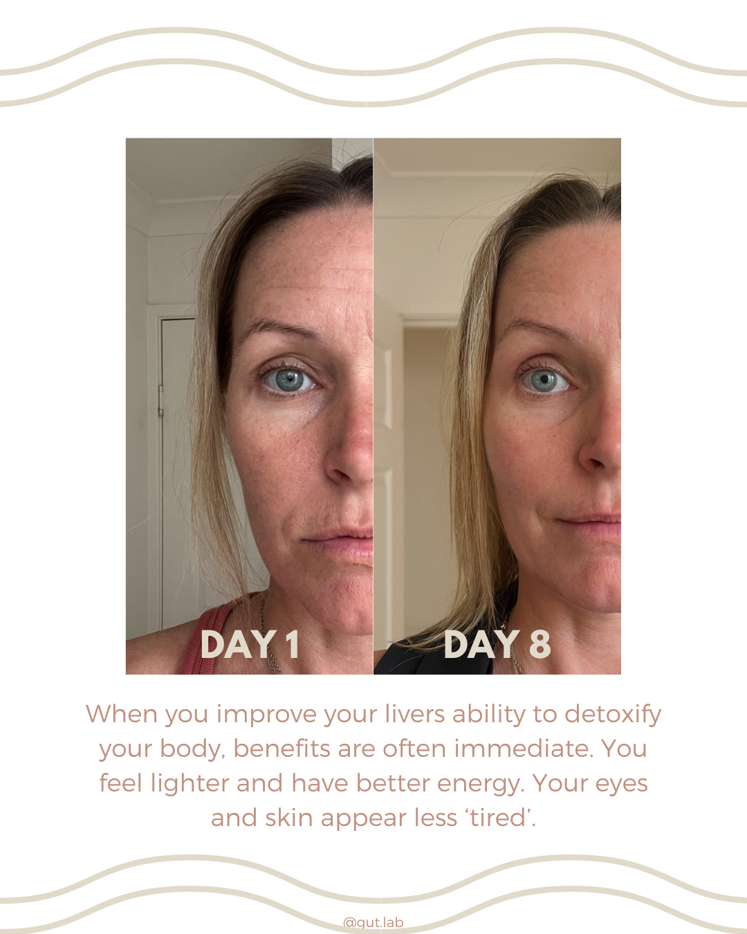 liver flush before and after images, beauty benefits. Natural botox