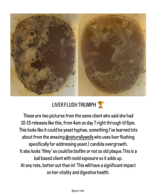 Two images of a dark, foamy substance in a container, showing changes in appearance. The first image depicts a darker, more bubbly substance, while the second shows a lighter, less bubbly mixture.