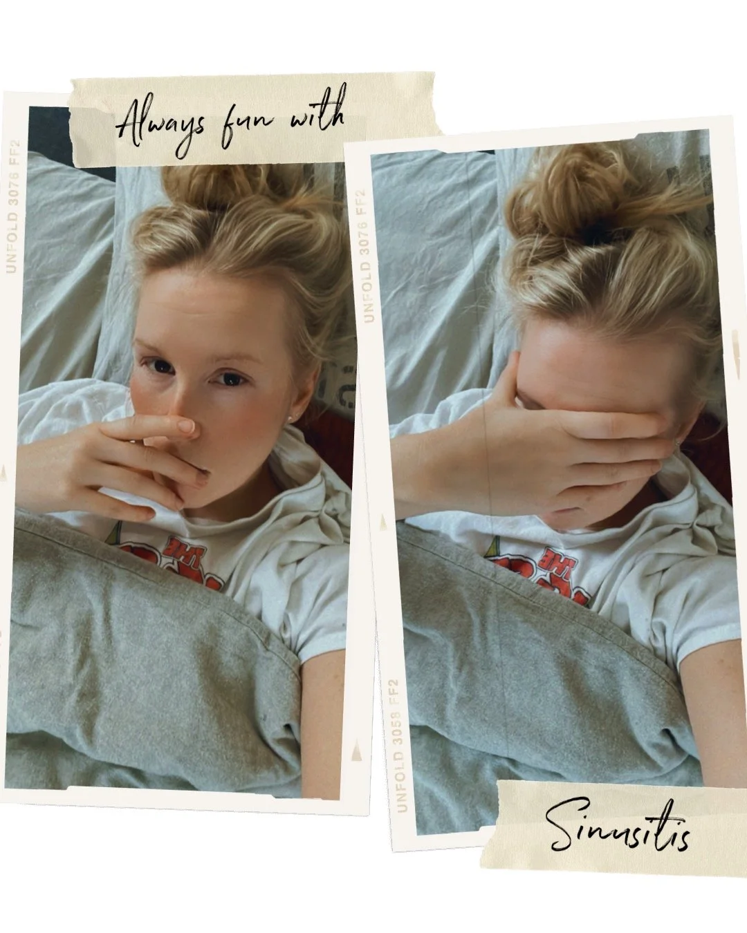 Sinusitis.JPG