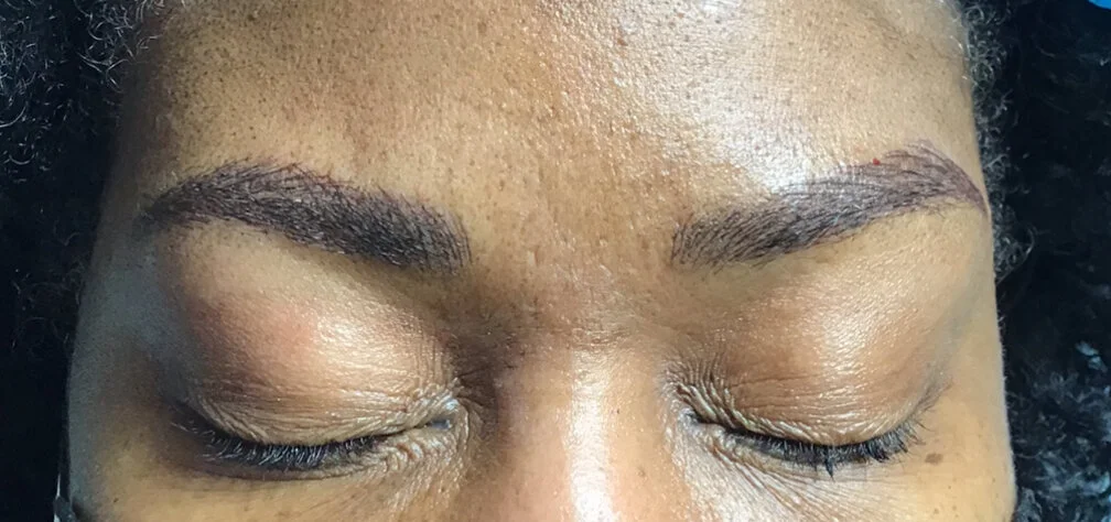 Combination Brow