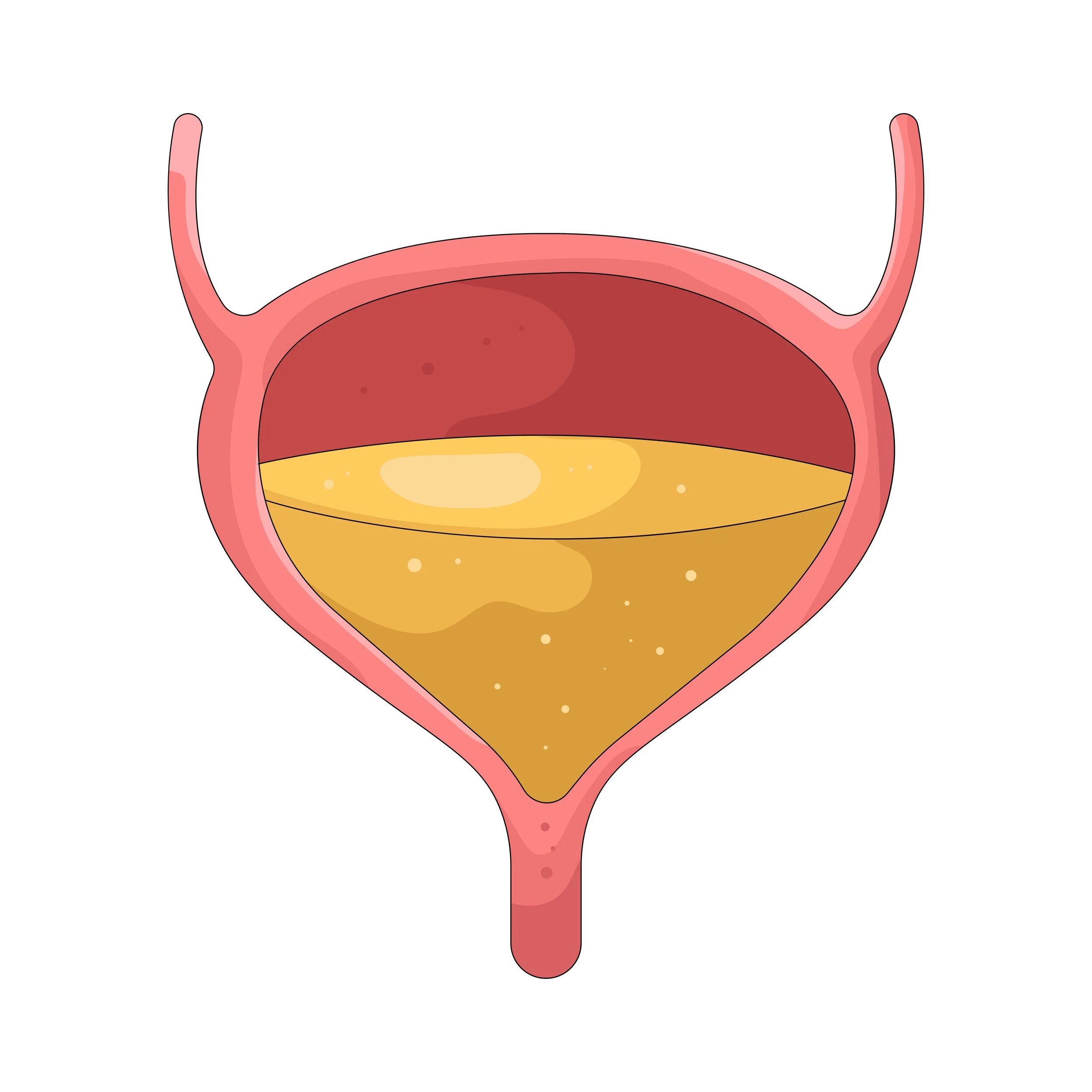 Blase im Dauerstress