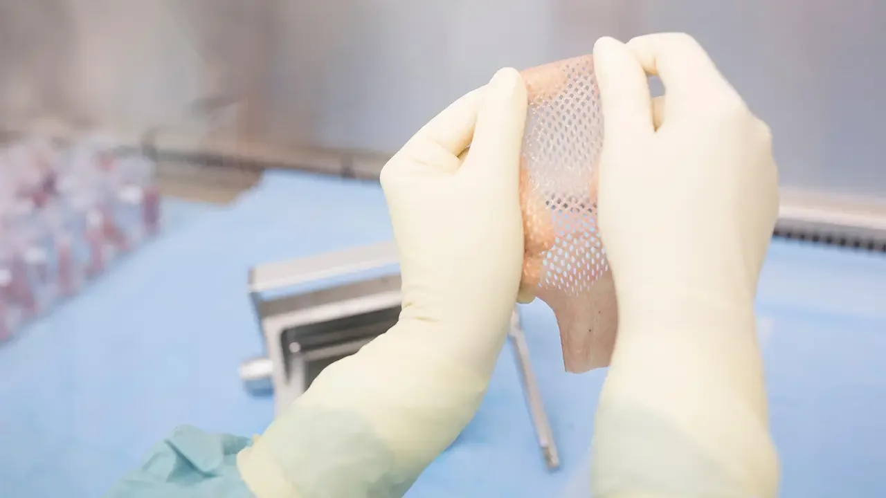 Experts Sound the Alarm on Pricey Skin Substitutes in Wound Care Industry