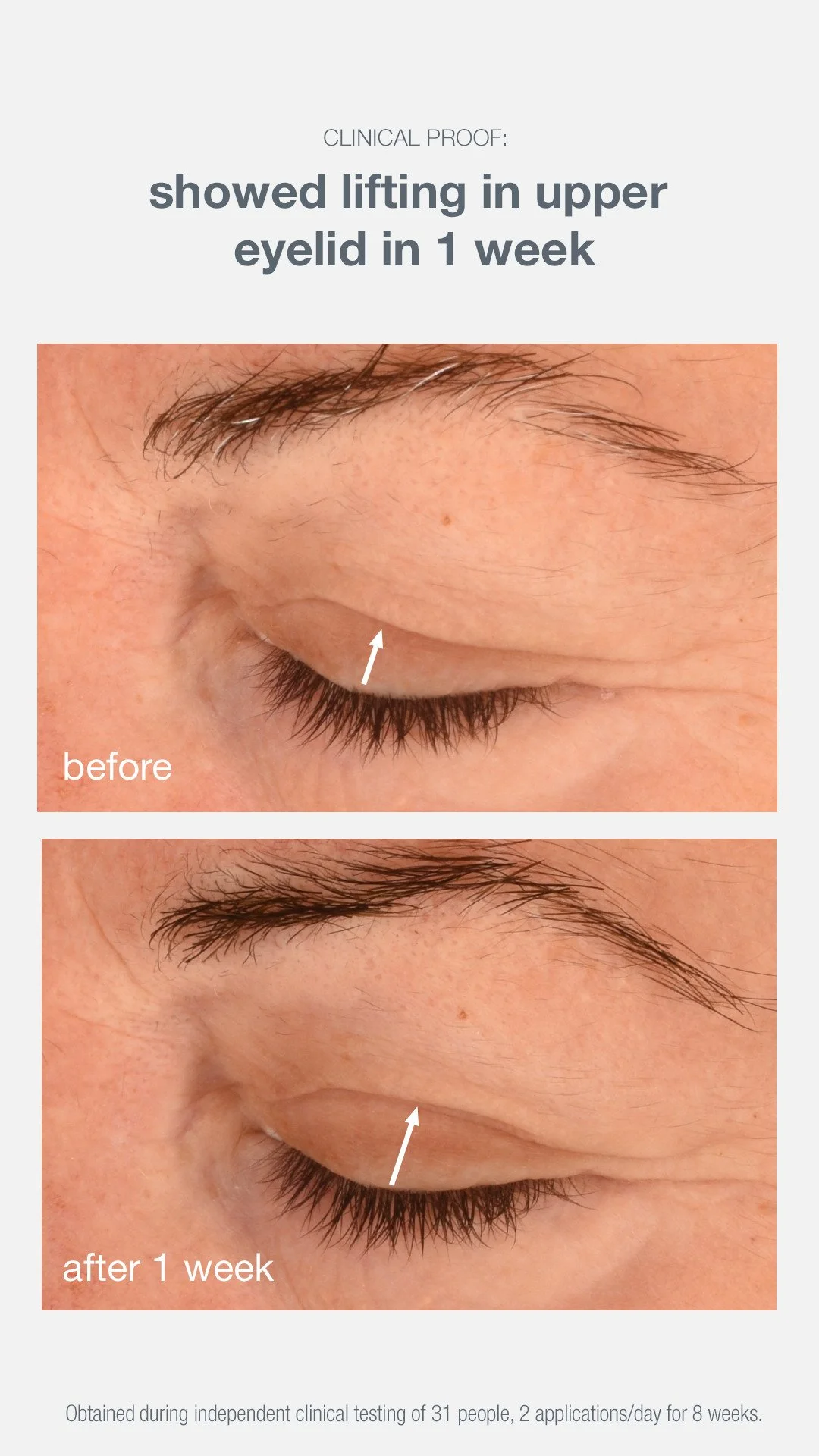 Phyto Nature Eye Cream_BA_claim_2 9x16BA 1 week.jpg