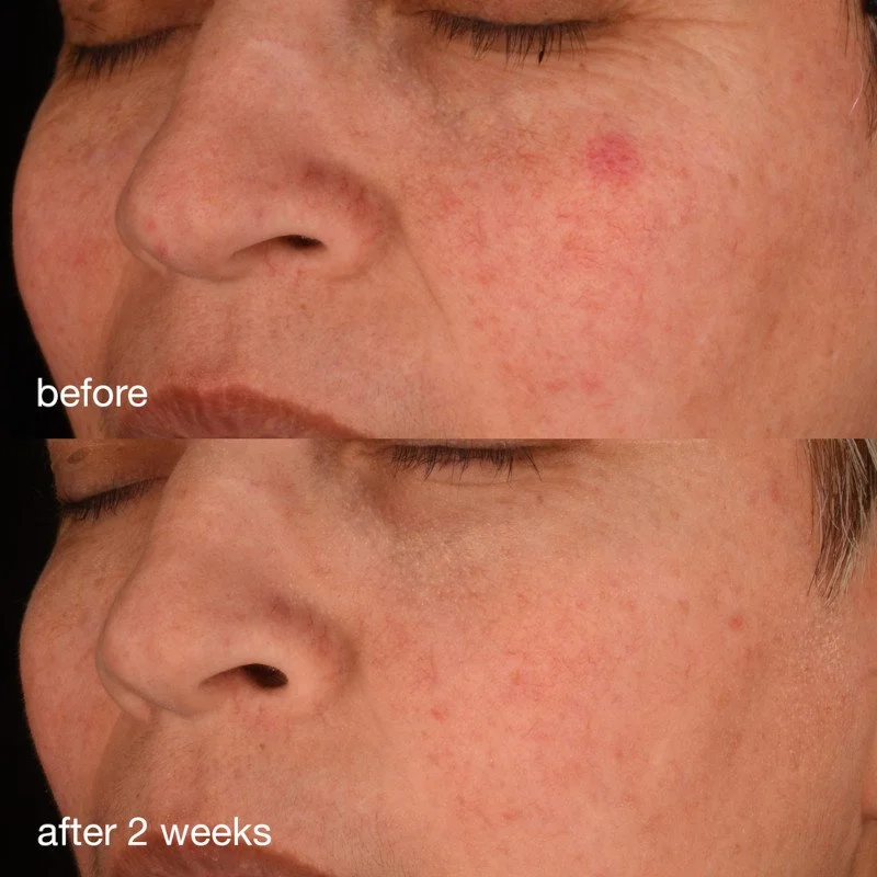 Pro Collagen Banking Serum BA 1x1 3.jpg