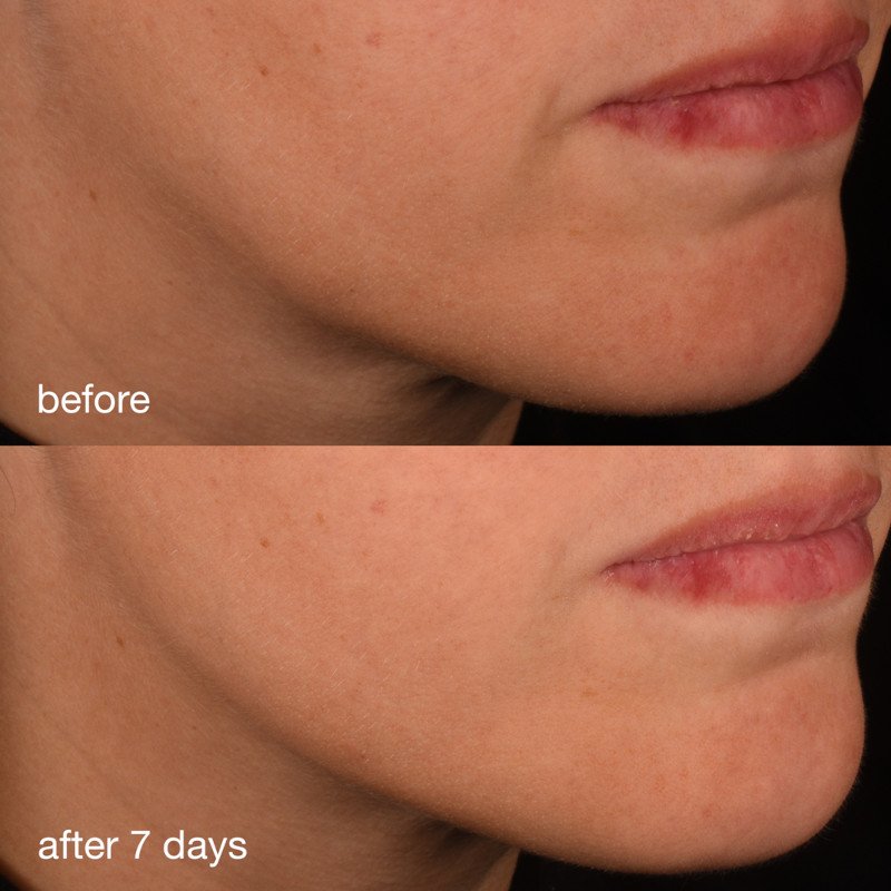 Pro Collagen Banking Serum BA 1x1 1.jpg