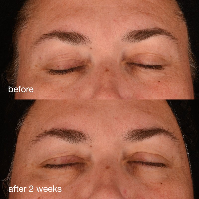 Pro Collagen Banking Serum BA 1x1 4.jpg