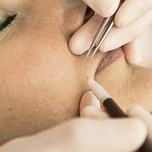 trielectrolysis.homepage pic (002).jpg