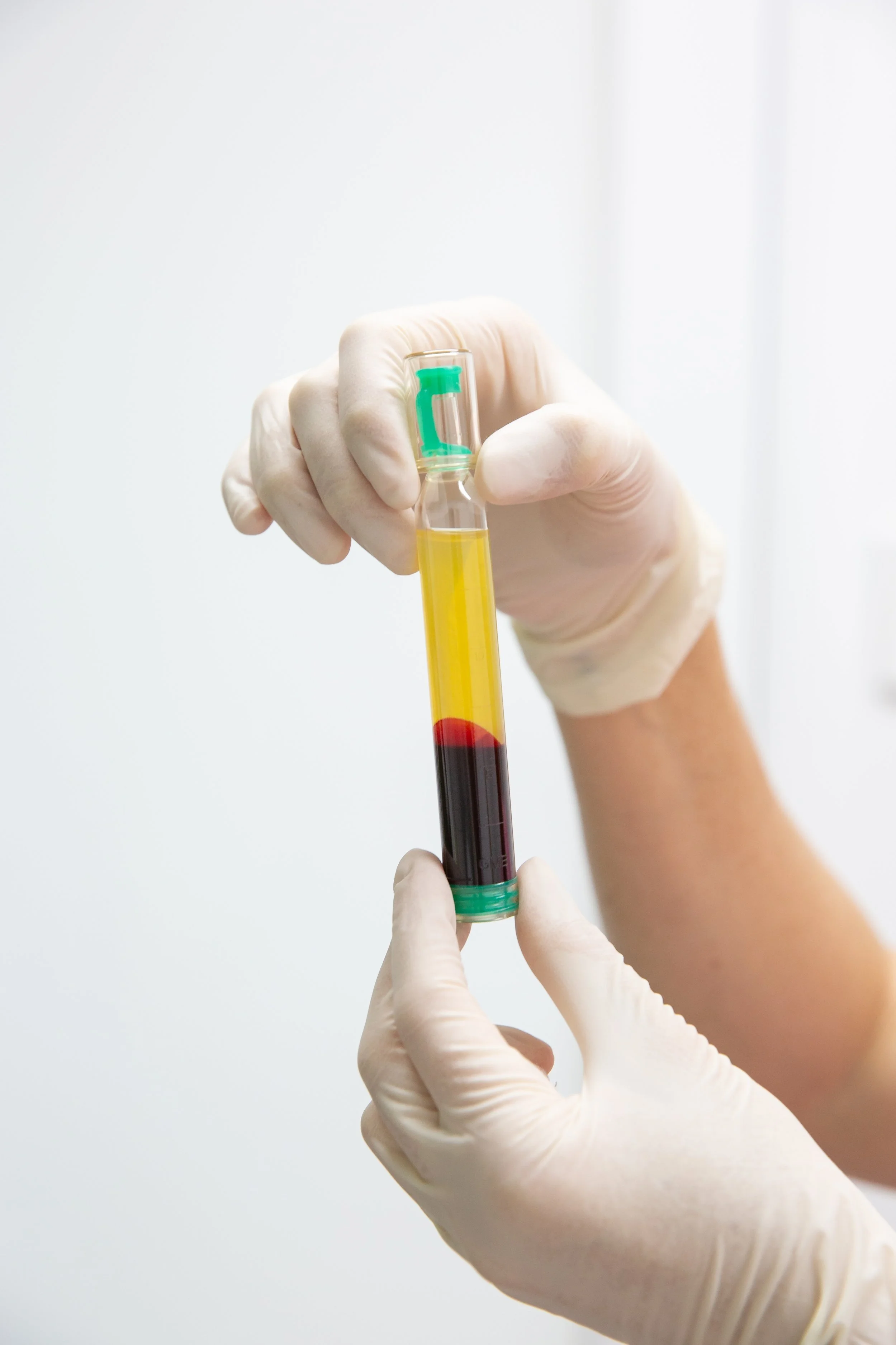 A person wearing gloves holding a test tube with yellow and red liquid inside.