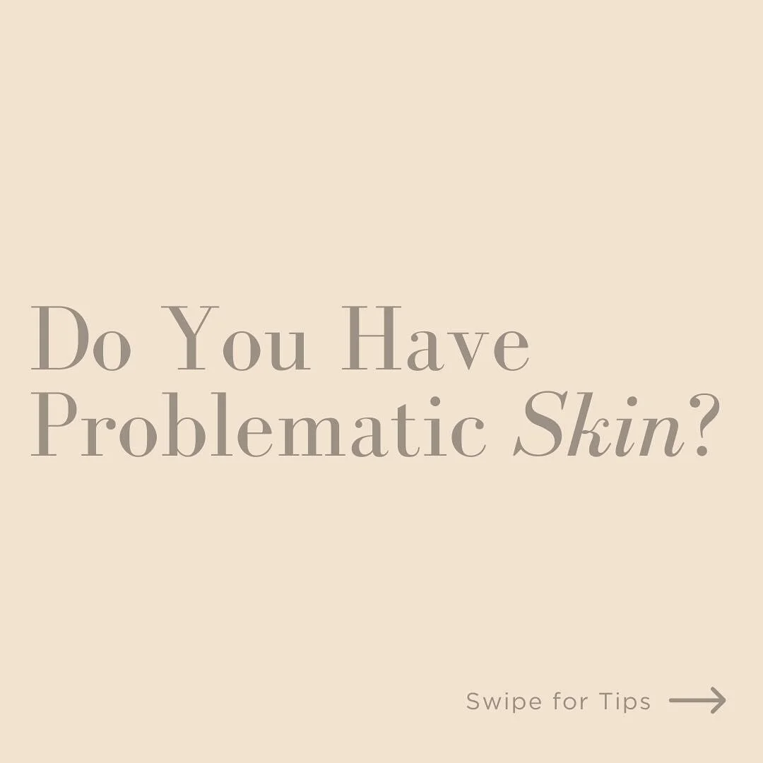 Do you have problematic skin?

Acne or break outs occur when the pores of your skin become blocked with oil, dead skin, or bacteria. For most people, good and bad skin days aside, they just want to have clear skin days and not worry about acne or bre