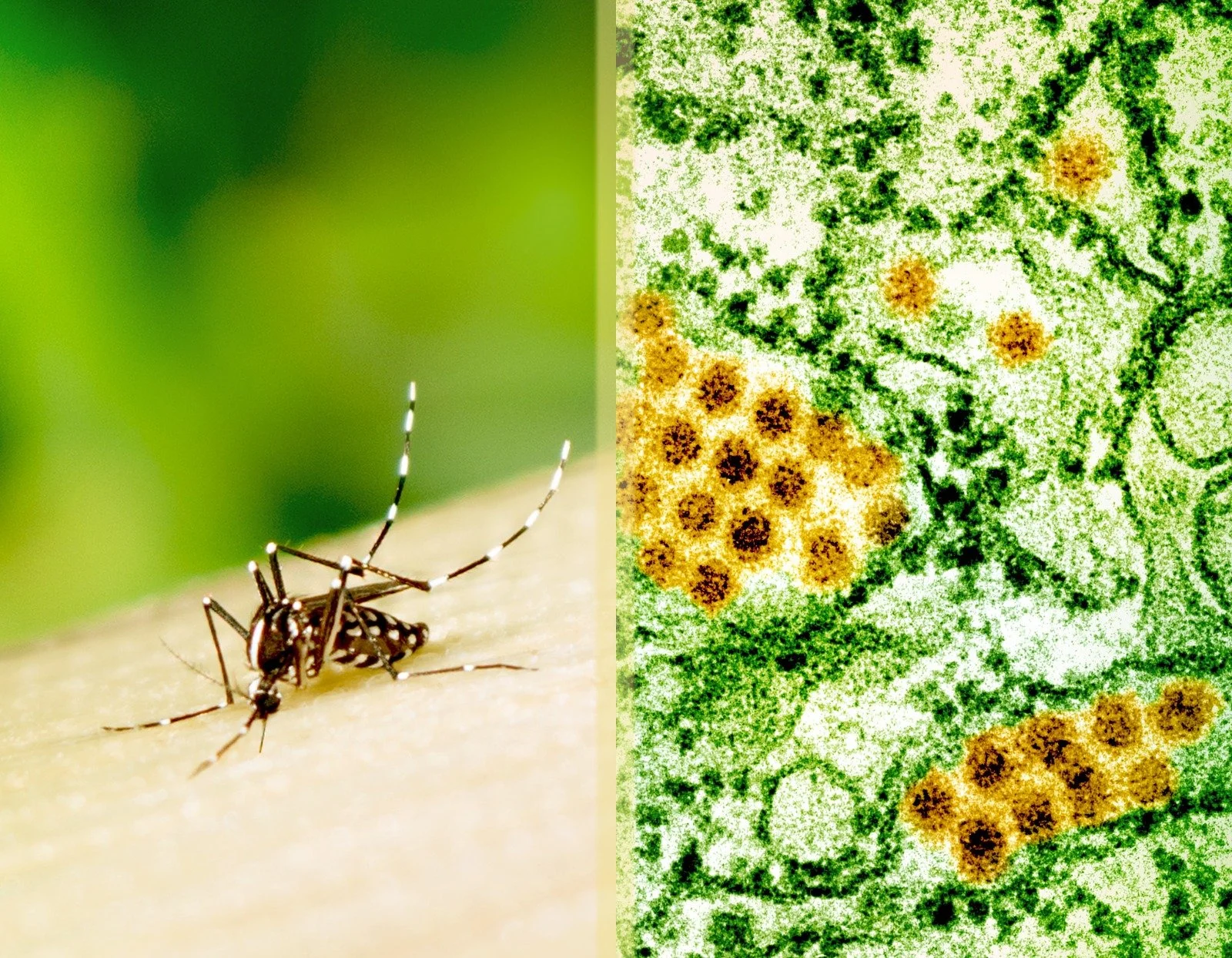 Dengue Fever Thumb Nail.jpeg