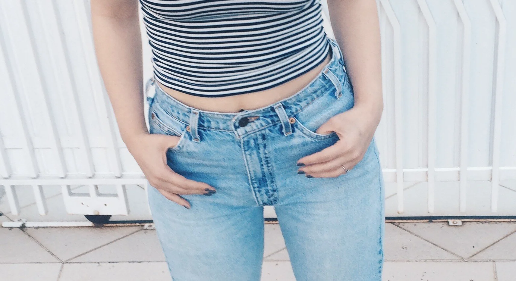 Criolipólise Curitiba 