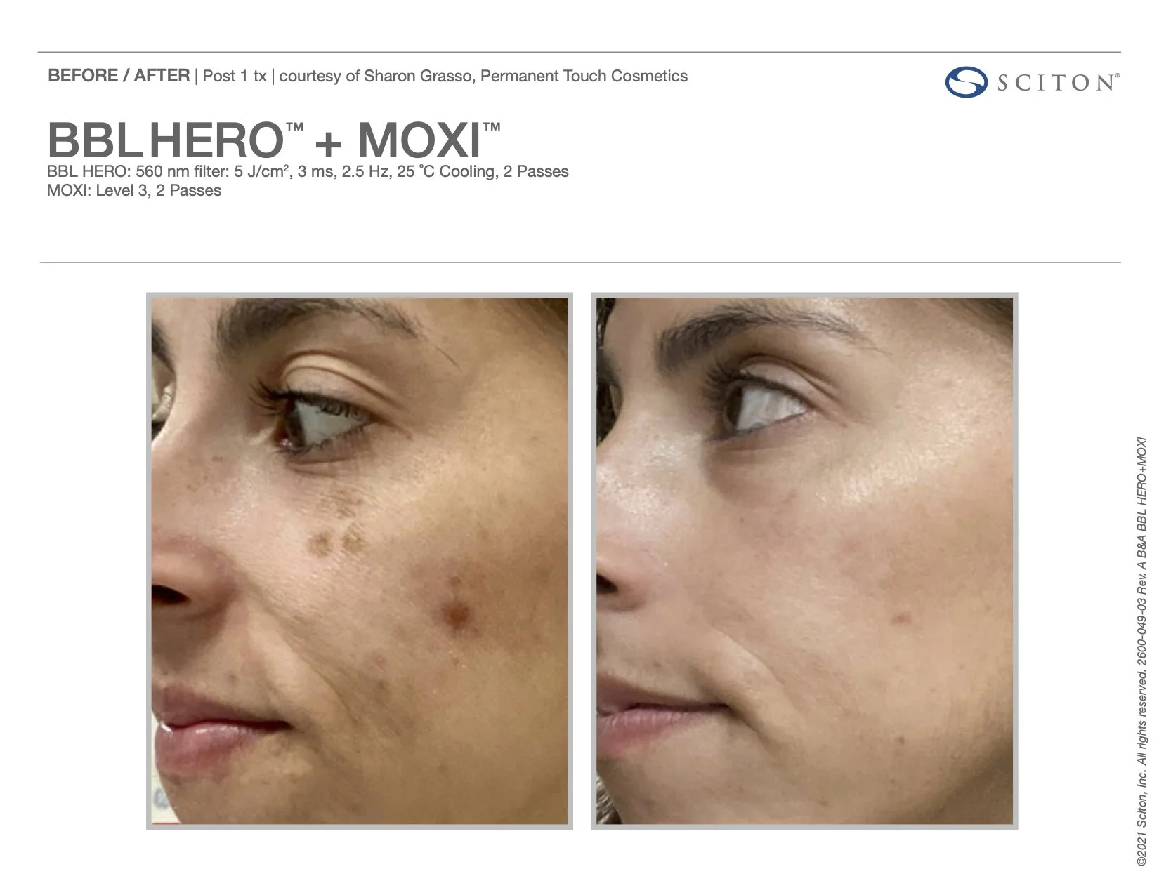 2600-049-03 Rev A B_A Photos, BBL HERO+MOXI_(binder).jpg