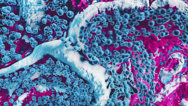 textura 2.gif