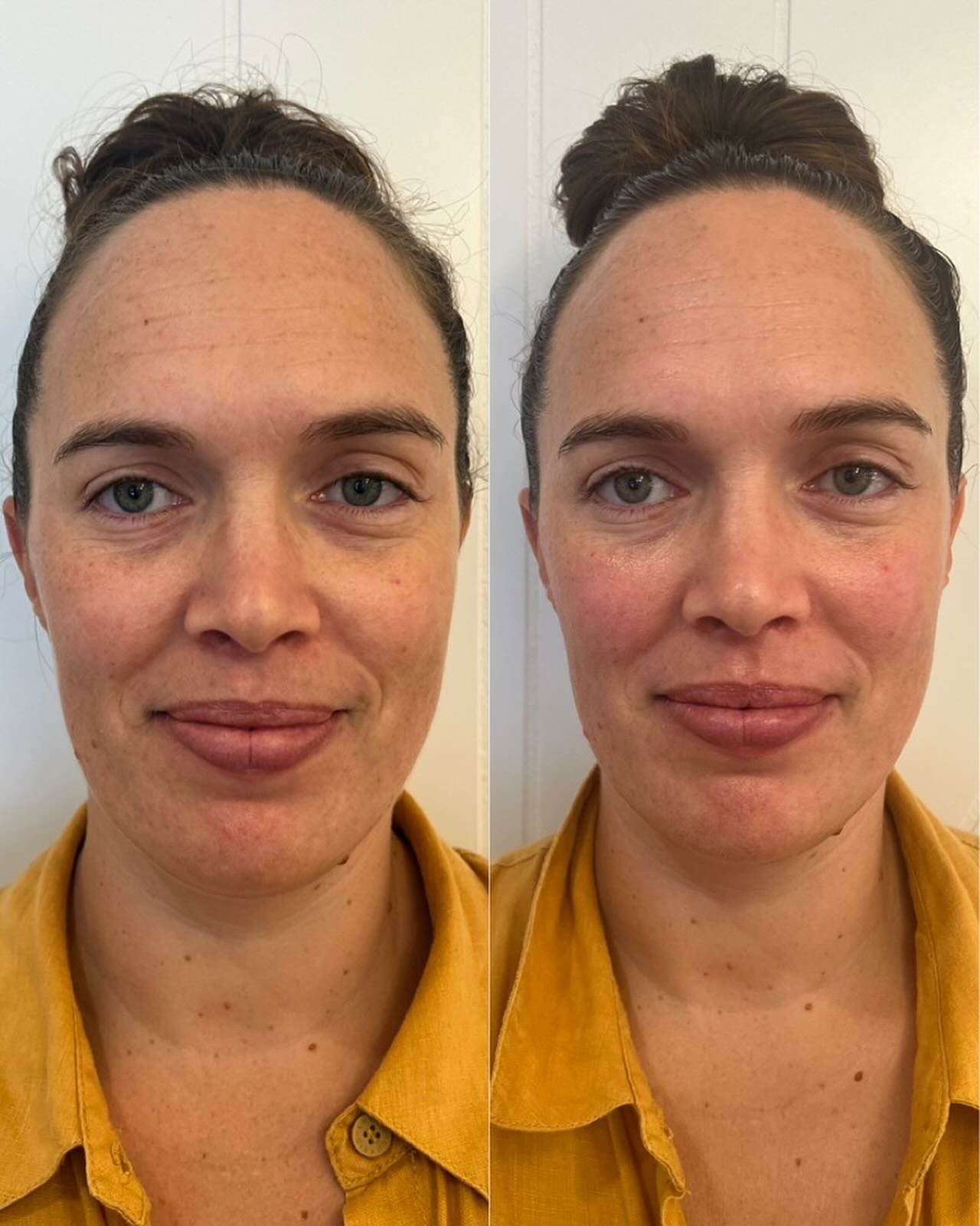 Some of the before &amp; afters of the face sculpting massage I&rsquo;ve been working on to share with you. The results are mind blowing 🤯 

I&rsquo;ve been learning the Neolifting Technique which helps to:
▫️ relax facial muscles and improve muscle