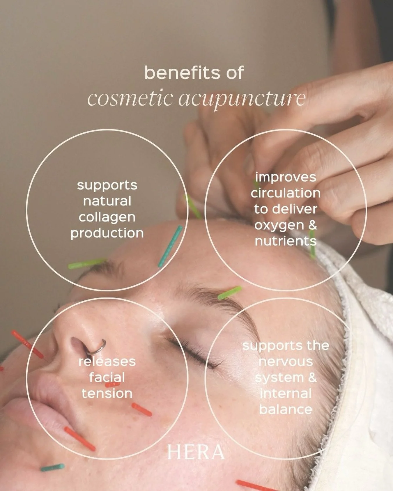 Cosmetic acupuncture works on multiple levels, supporting the skin&rsquo;s natural function while also addressing what&rsquo;s happening beneath the surface.

By stimulating circulation, encouraging collagen production, and releasing areas of tension