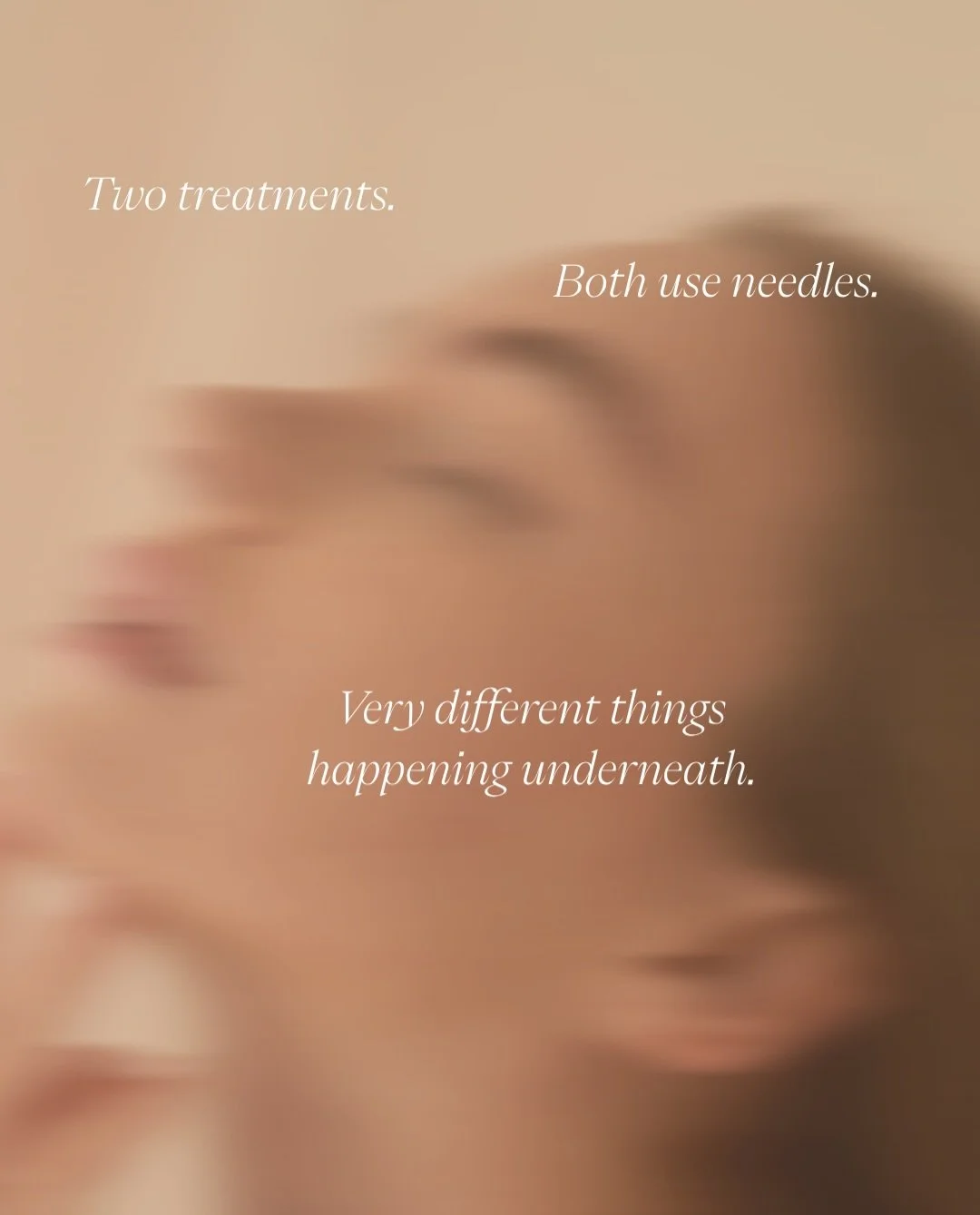 The clients who ask me about cosmetic acupuncture and skin needling are usually trying to choose between them. What most of them don&rsquo;t realise is that for a lot of the concerns they&rsquo;re describing, the answer isn&rsquo;t either or. It&rsqu