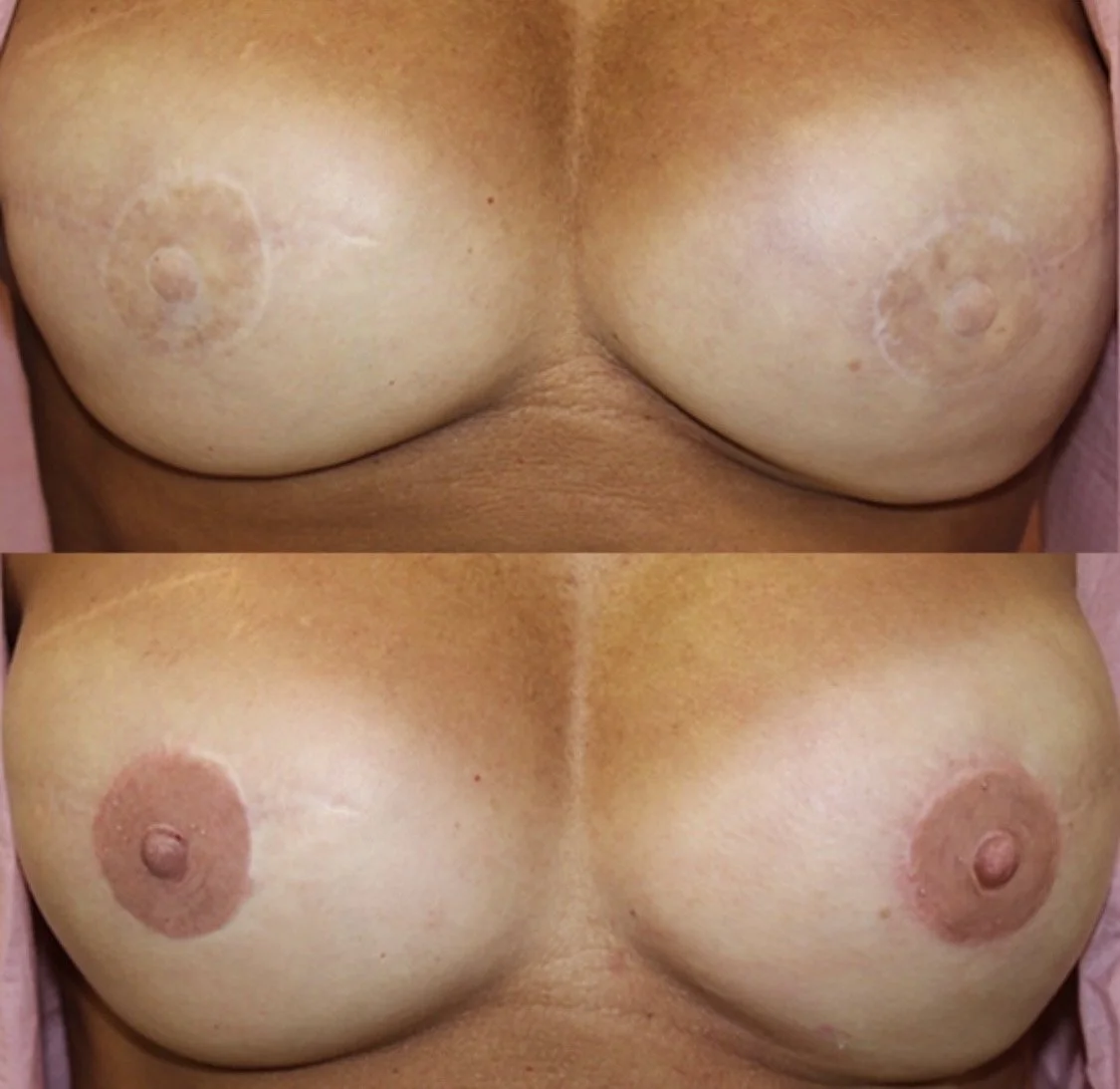 Artist: Beatrice (CosMed.Ink)