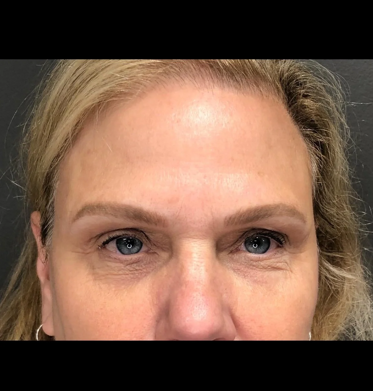 Darlene - Brows 2 - After.jpg