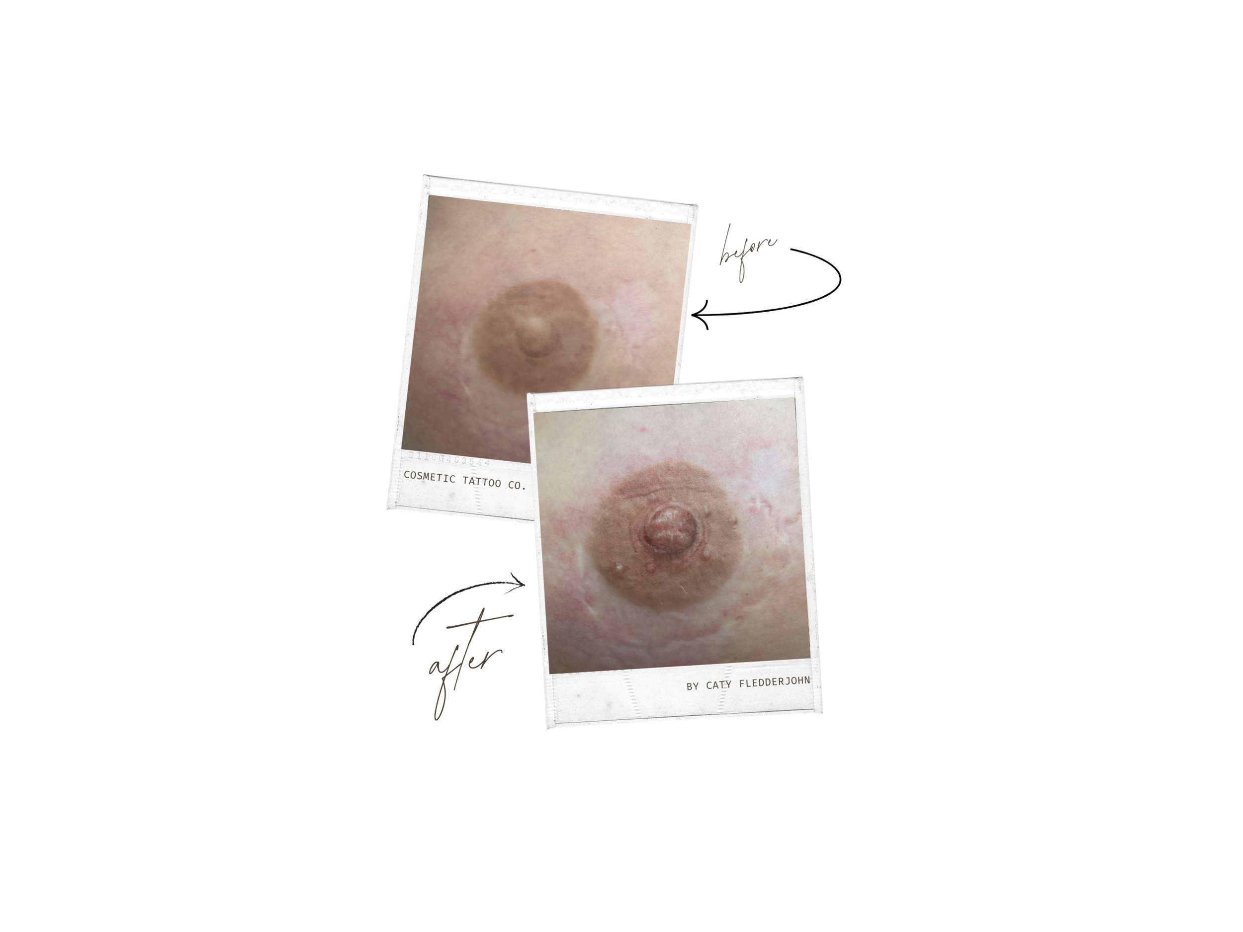Caty - Nipple Before & After.png