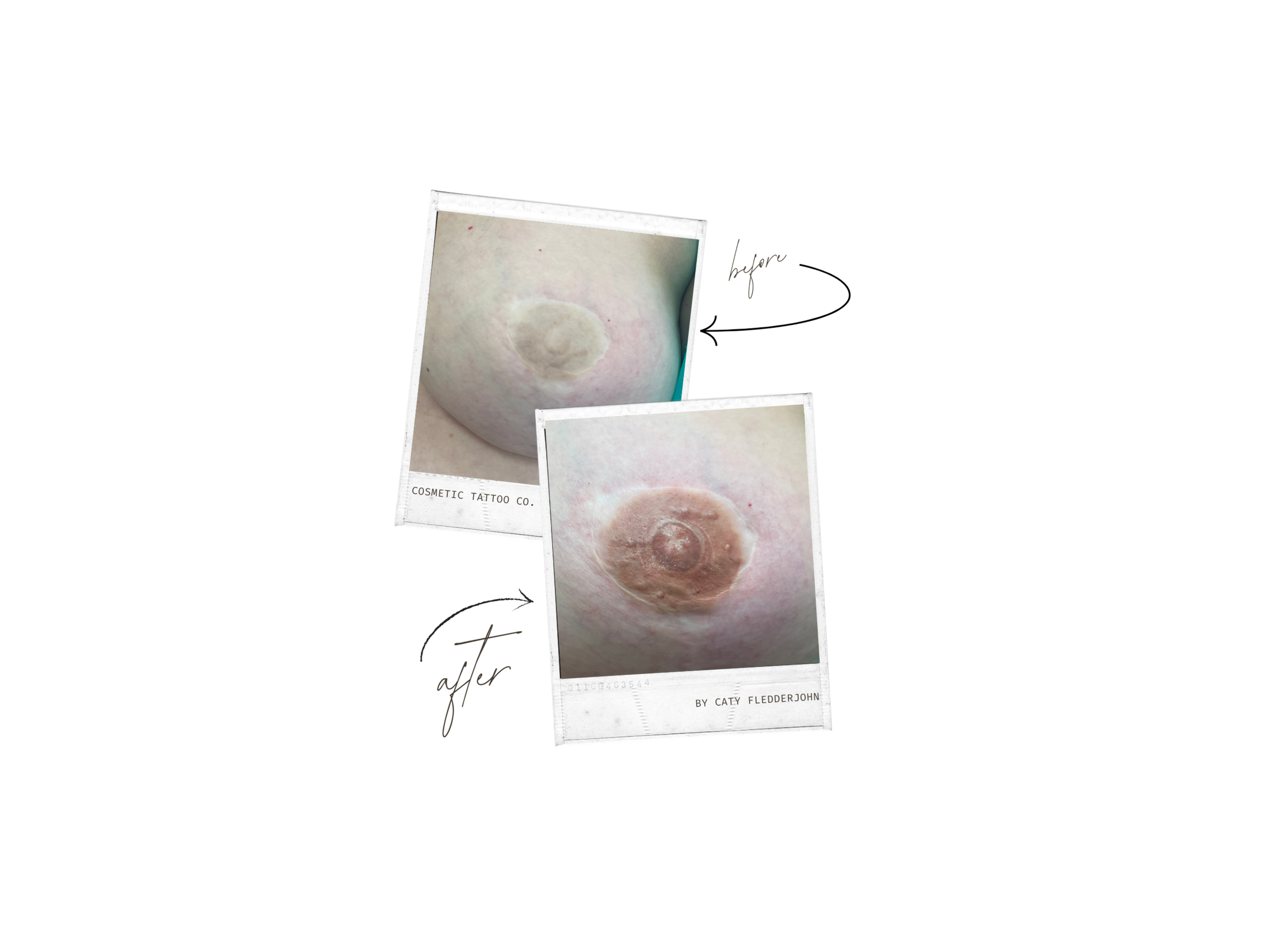Caty - Nipple Before & After 2.png