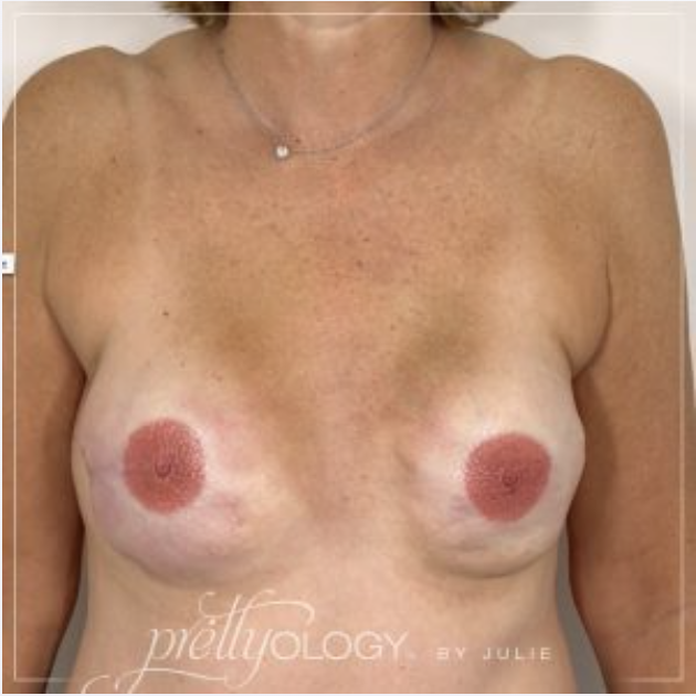 Prettyology - After 3.png