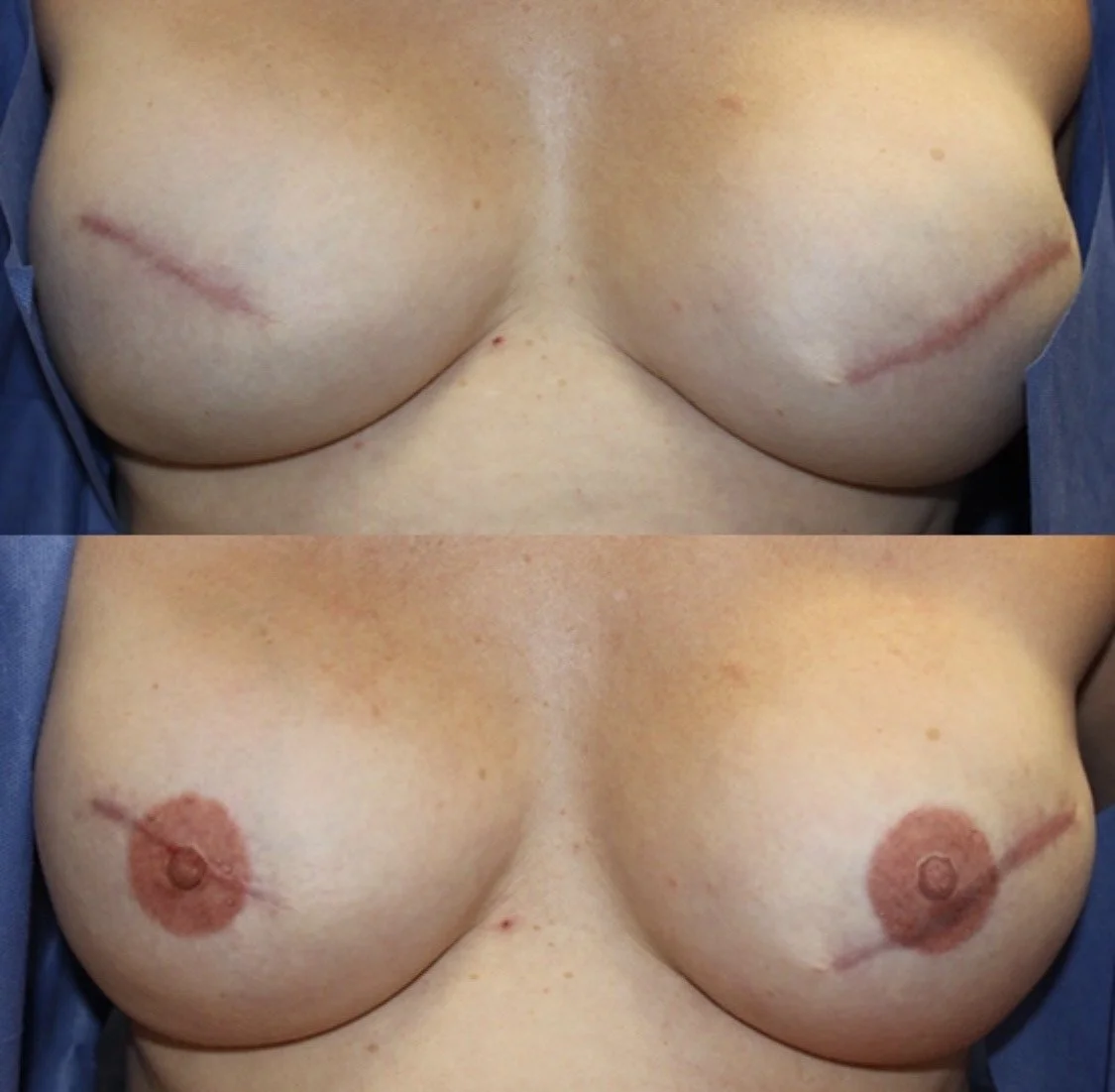 Artist: Beatrice (CosMed.Ink)