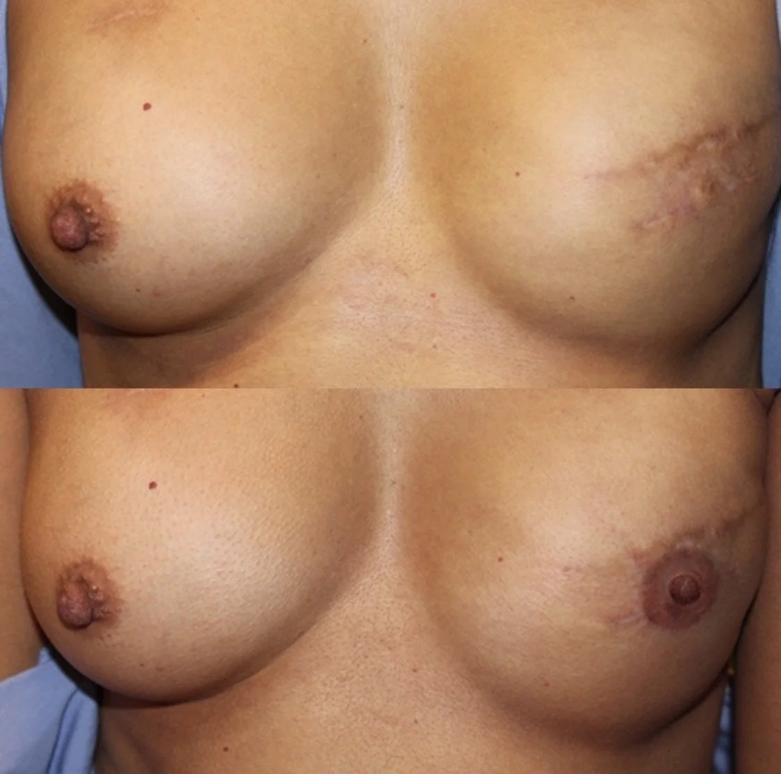 Artist: Beatrice (CosMed.Ink)