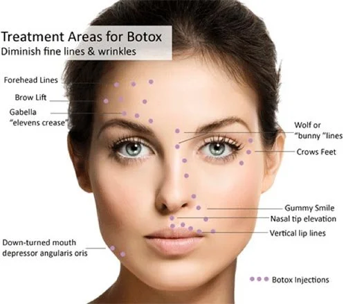 Botox & Wrinkle Relaxers in Tuckahoe, NY | DR. G Prevention & Wellness