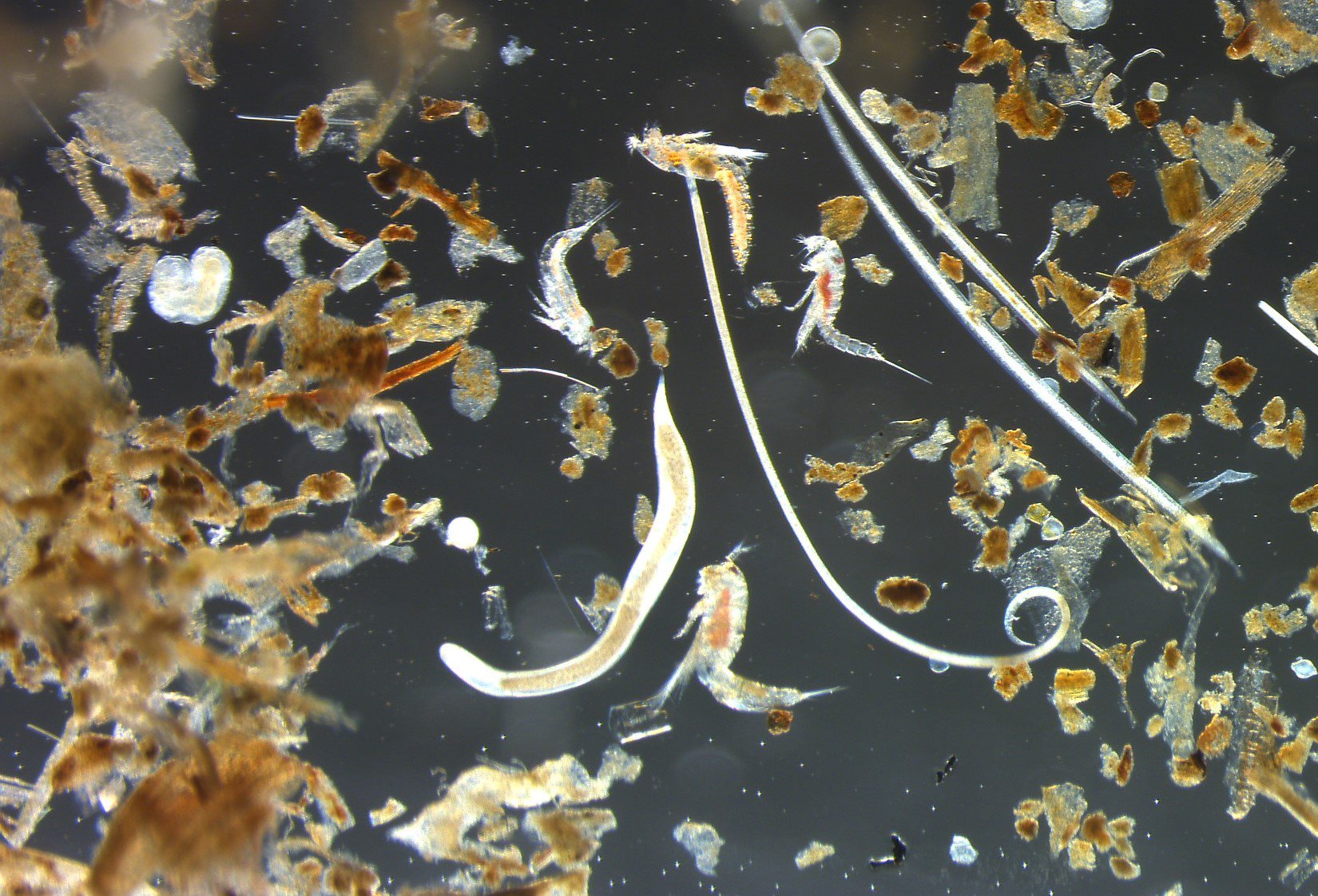 Microscopic meiofauna that live in the sand